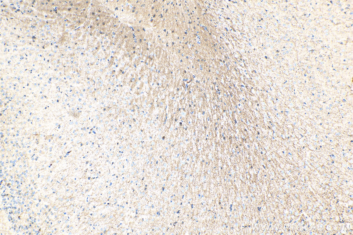 Immunohistochemistry (IHC) staining of rat brain tissue using SIRT2 Polyclonal antibody (19655-1-AP)