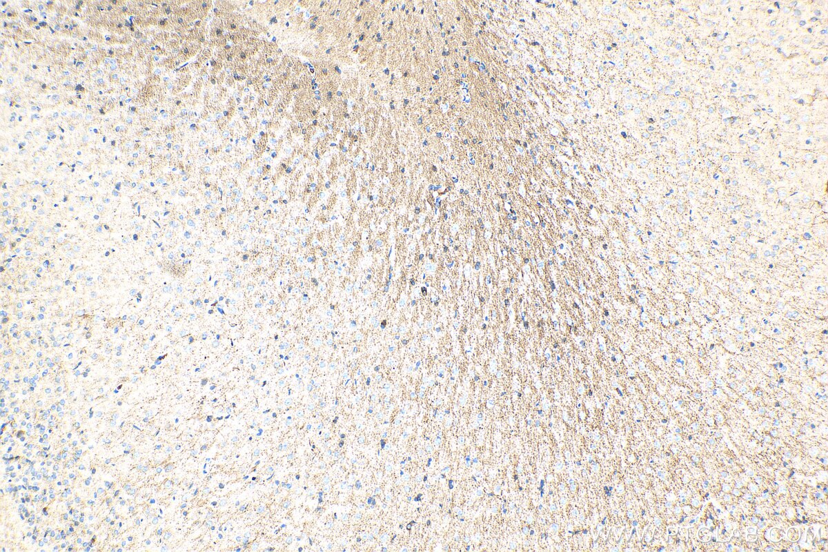 IHC staining of rat brain using 19655-1-AP