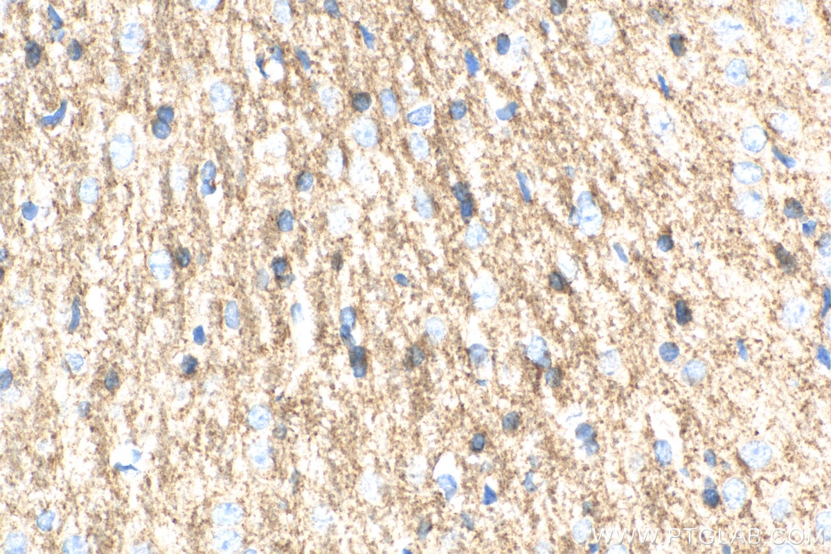 Immunohistochemistry (IHC) staining of rat brain tissue using SIRT2 Polyclonal antibody (19655-1-AP)