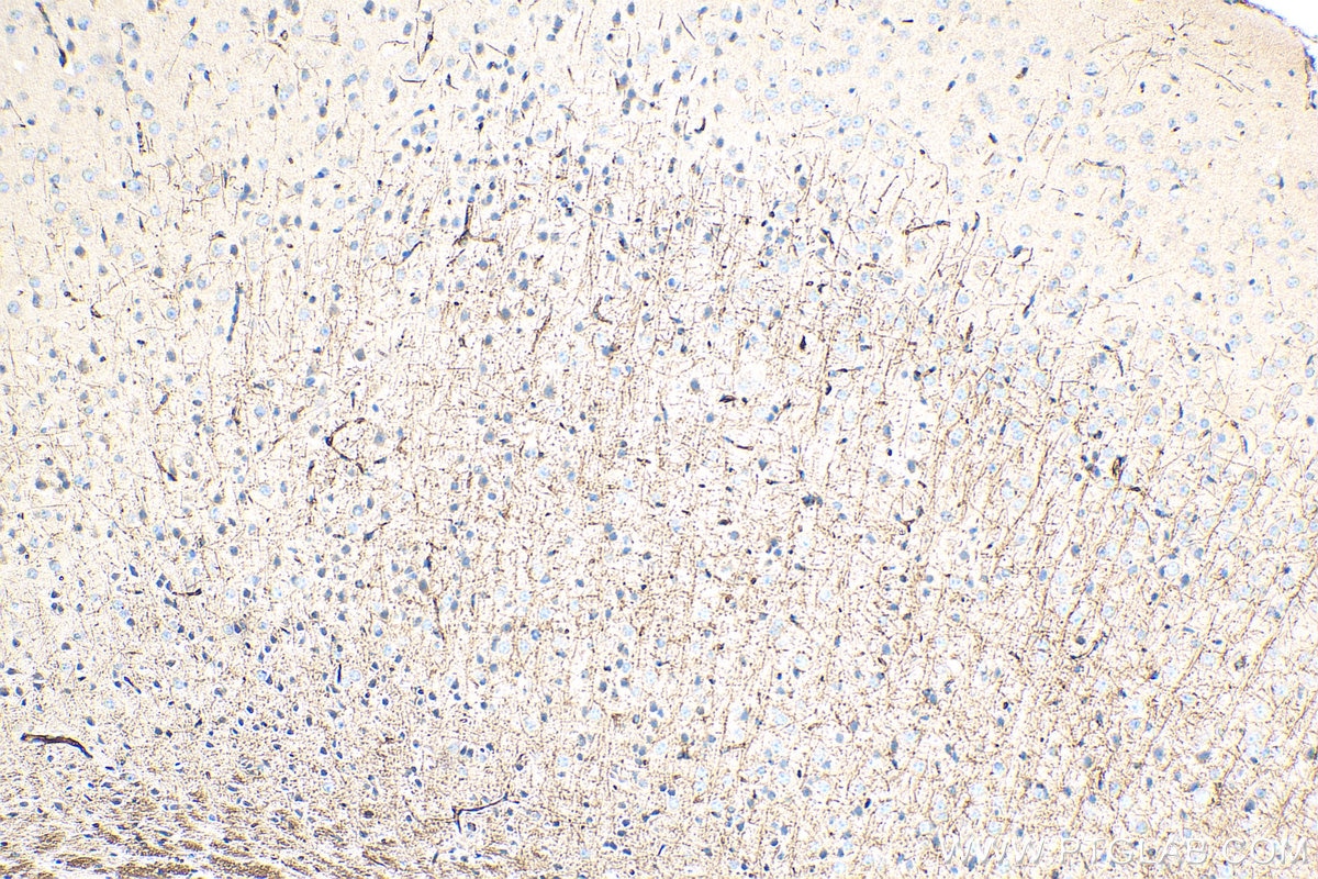 Immunohistochemistry (IHC) staining of mouse brain tissue using SIRT2 Polyclonal antibody (19655-1-AP)