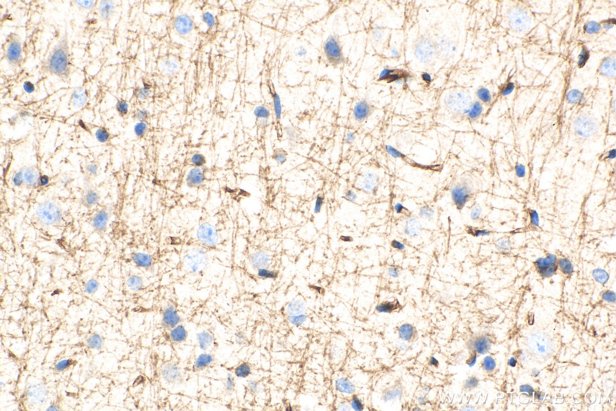 Immunohistochemistry (IHC) staining of mouse brain tissue using SIRT2 Polyclonal antibody (19655-1-AP)