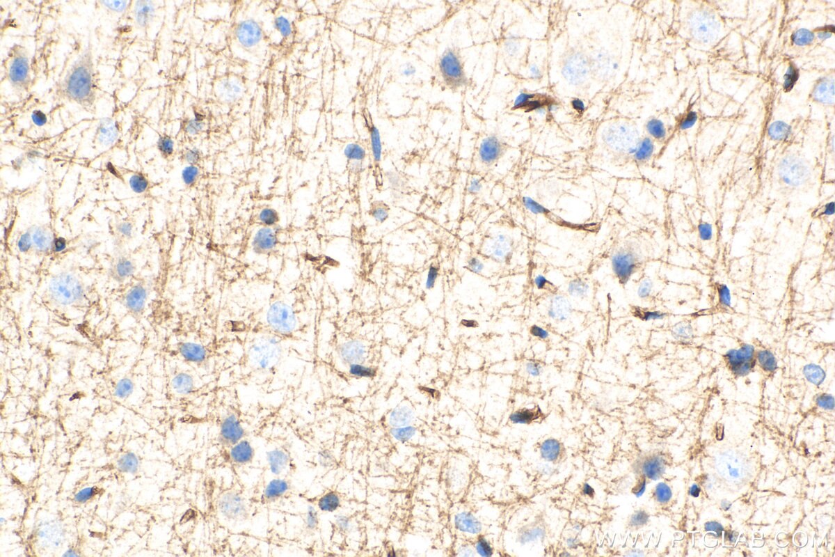 IHC staining of mouse brain using 19655-1-AP