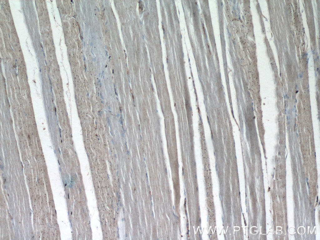 IHC staining of human skeletal muscle using 19655-1-AP
