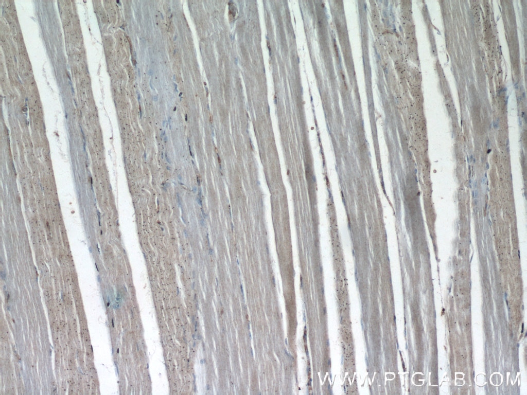 Immunohistochemistry (IHC) staining of human skeletal muscle tissue using SIRT2 Polyclonal antibody (19655-1-AP)