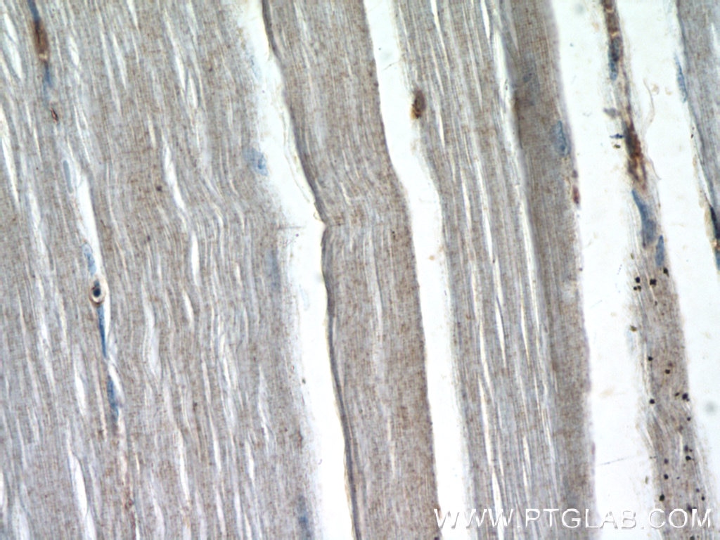 Immunohistochemistry (IHC) staining of human skeletal muscle tissue using SIRT2 Polyclonal antibody (19655-1-AP)