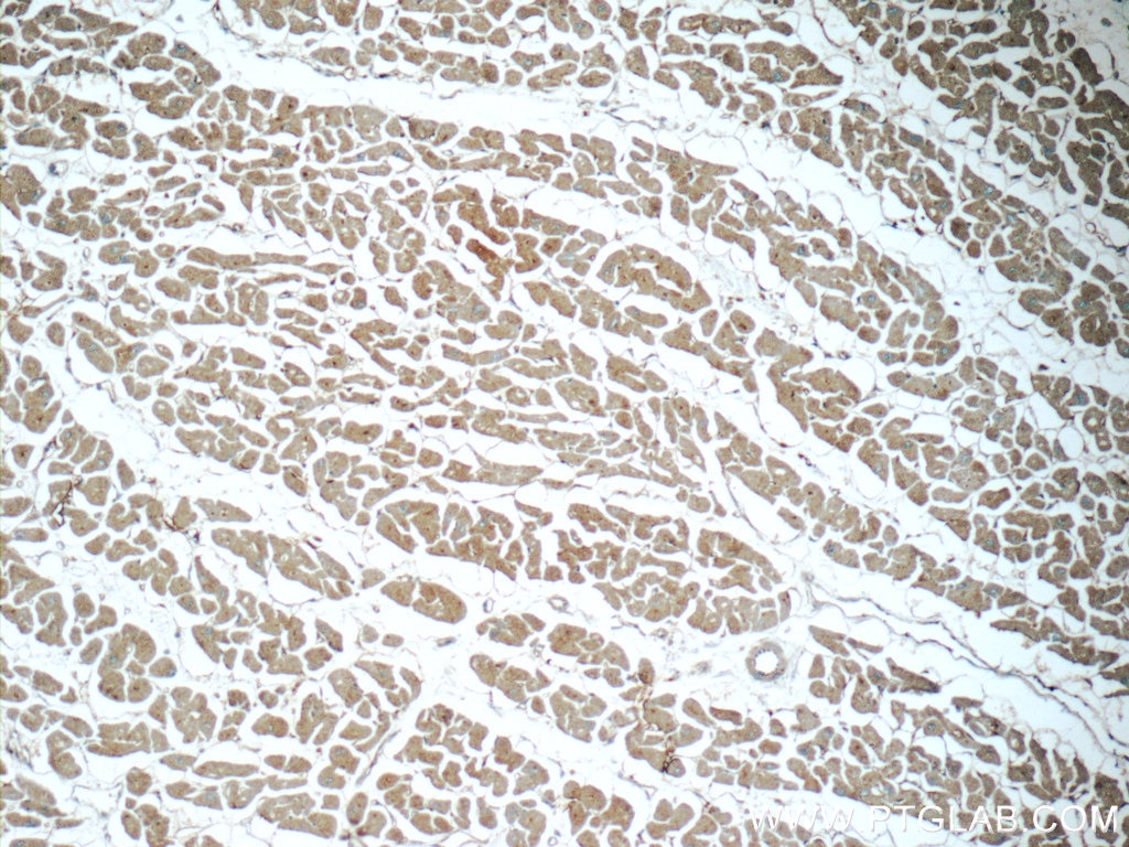 Immunohistochemistry (IHC) staining of human heart tissue using SIRT2 Polyclonal antibody (19655-1-AP)