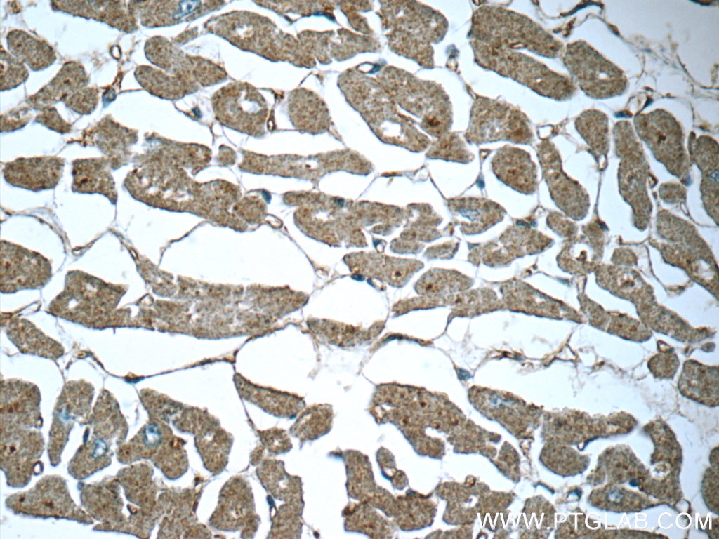 Immunohistochemistry (IHC) staining of human heart tissue using SIRT2 Polyclonal antibody (19655-1-AP)