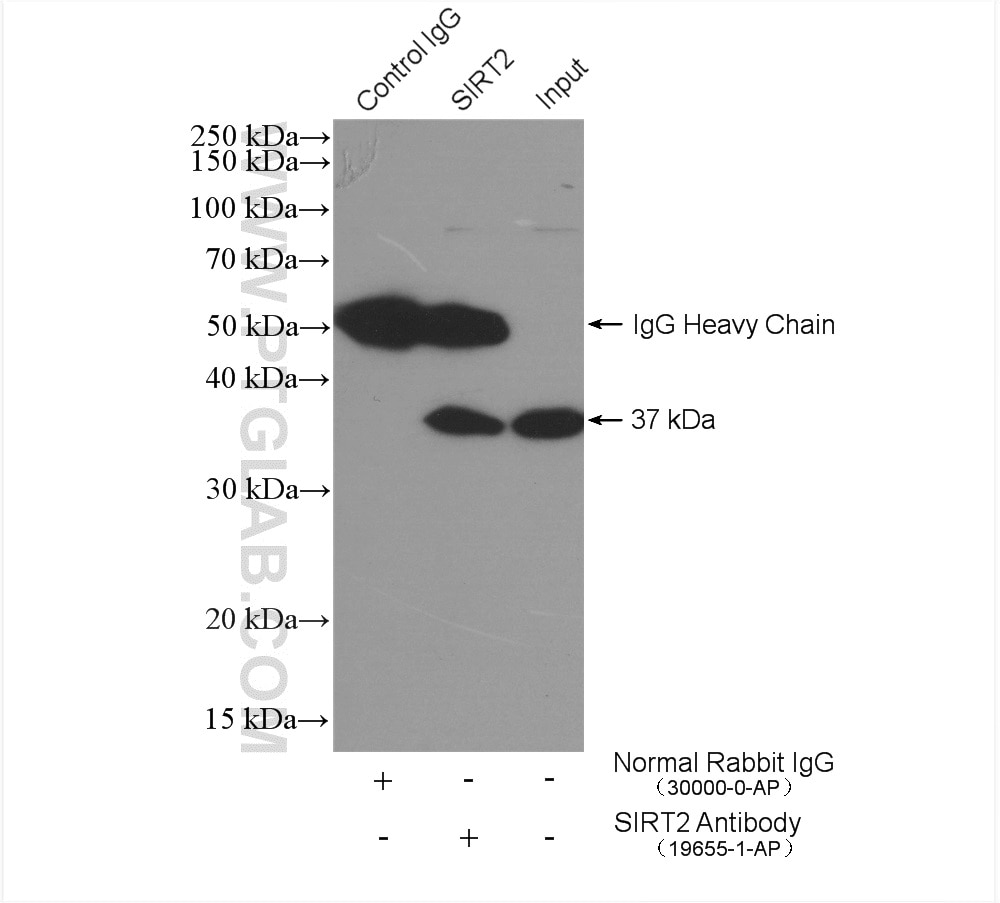 Immunoprecipitation (IP) experiment of mouse brain tissue using SIRT2 Polyclonal antibody (19655-1-AP)