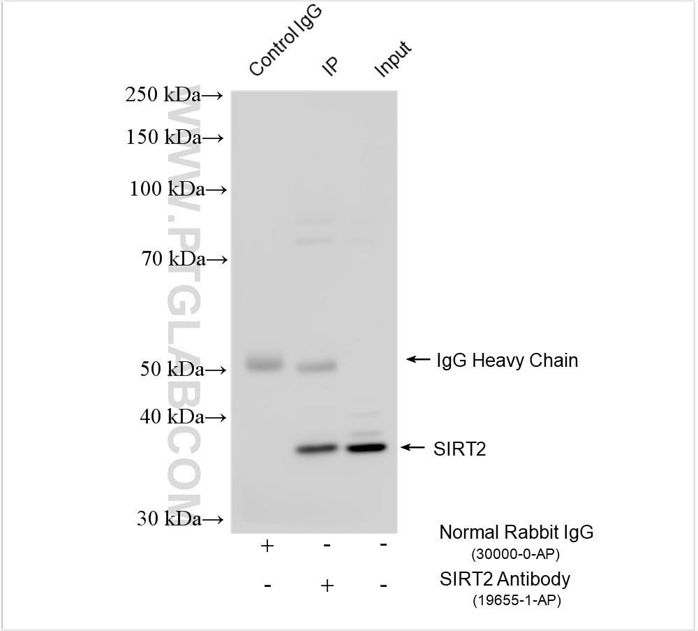 Immunoprecipitation (IP) experiment of mouse brain tissue using SIRT2 Polyclonal antibody (19655-1-AP)