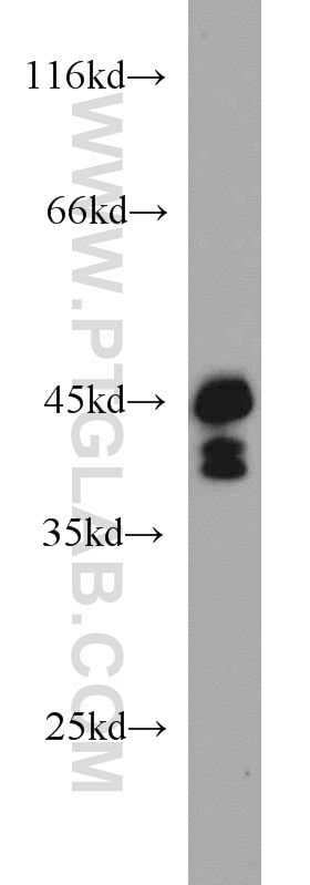 Western Blot (WB) analysis of human brain tissue using SIRT2 Polyclonal antibody (19655-1-AP)