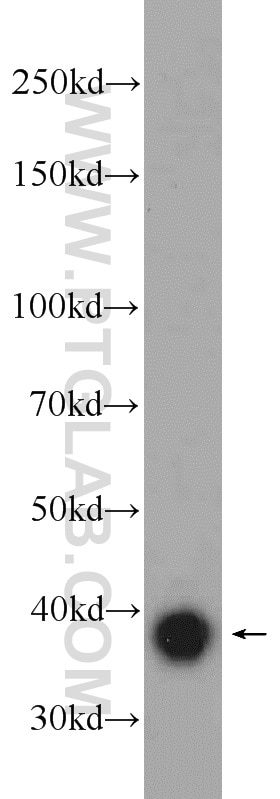 SIRT2 Polyclonal antibody