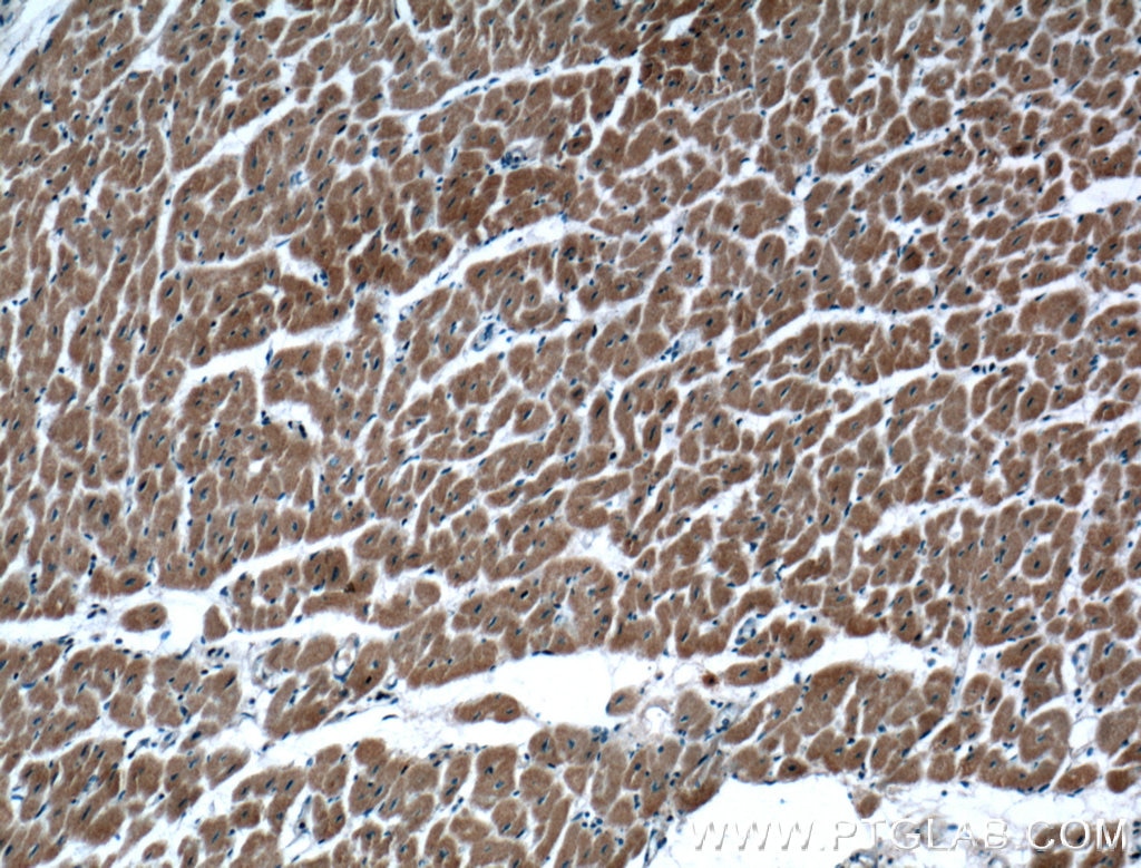Immunohistochemistry (IHC) staining of human heart tissue using SIRT2 Monoclonal antibody (66410-1-Ig)