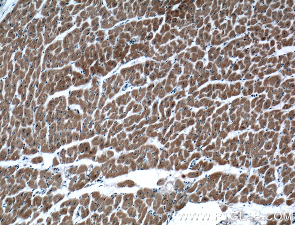 IHC staining of human heart using 66410-1-Ig