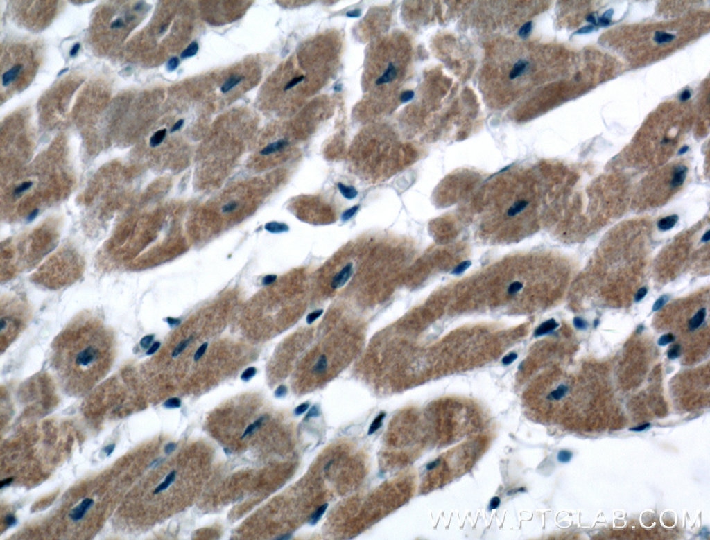 Immunohistochemistry (IHC) staining of human heart tissue using SIRT2 Monoclonal antibody (66410-1-Ig)