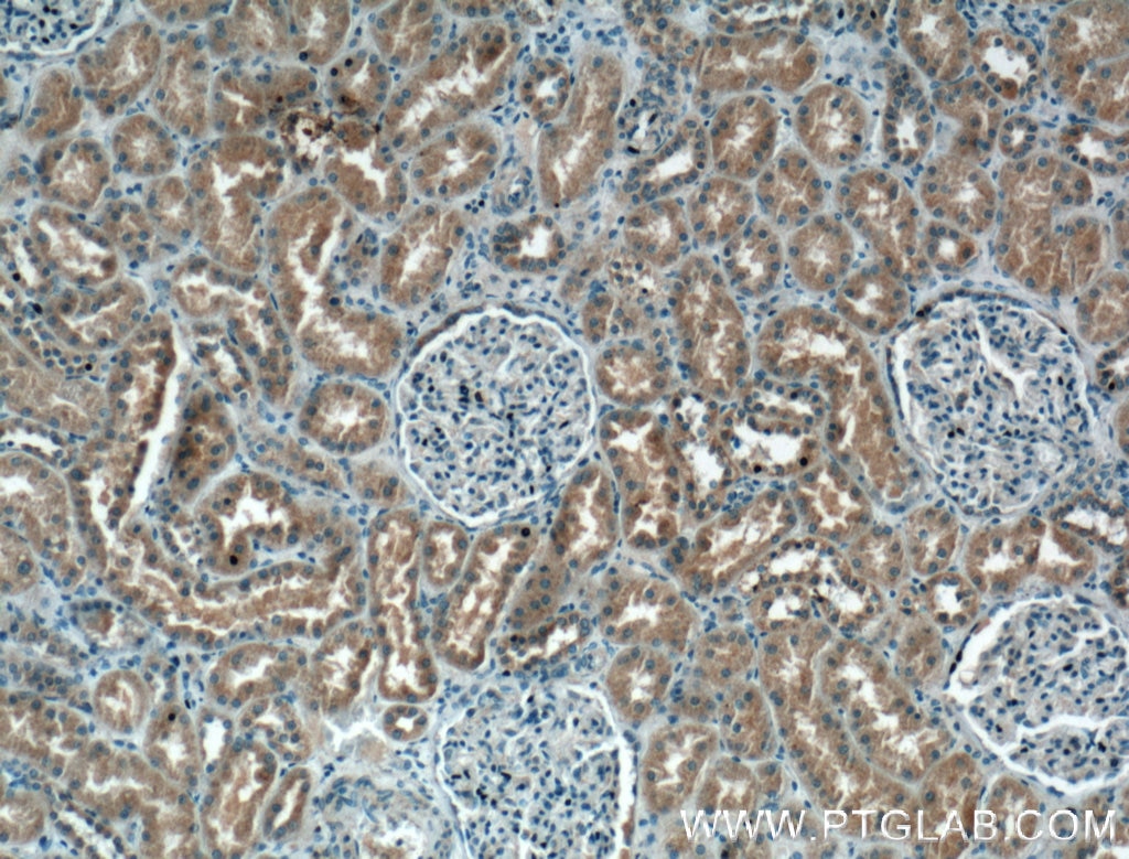 Immunohistochemistry (IHC) staining of human kidney tissue using SIRT2 Monoclonal antibody (66410-1-Ig)