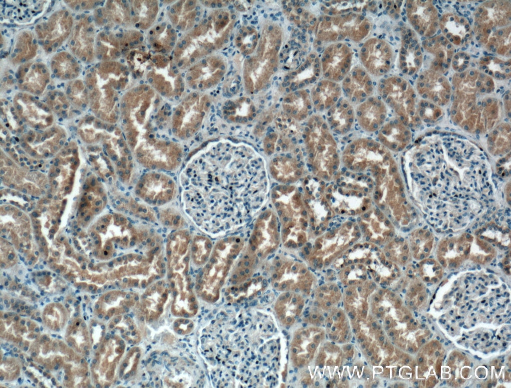 IHC staining of human kidney using 66410-1-Ig