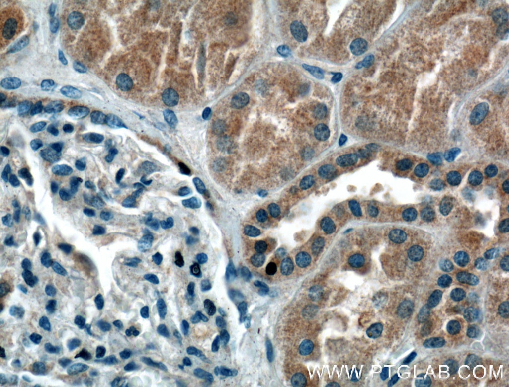 Immunohistochemistry (IHC) staining of human kidney tissue using SIRT2 Monoclonal antibody (66410-1-Ig)