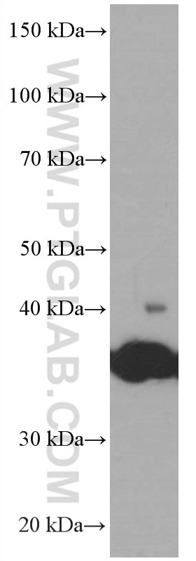 Western Blot (WB) analysis of rat brain tissue using SIRT2 Monoclonal antibody (66410-1-Ig)