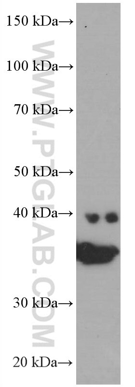 Western Blot (WB) analysis of mouse brain tissue using SIRT2 Monoclonal antibody (66410-1-Ig)