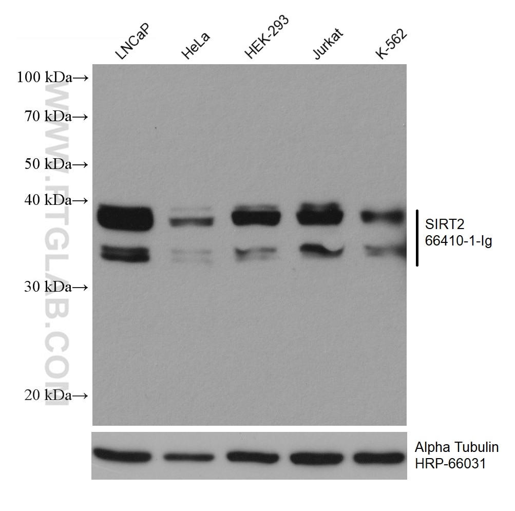 Western Blot (WB) analysis of various lysates using SIRT2 Monoclonal antibody (66410-1-Ig)