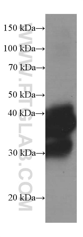 Western Blot (WB) analysis of mouse brain tissue using SIRT2 Monoclonal antibody (66410-1-Ig)