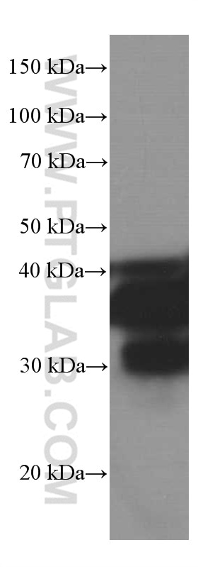 Western Blot (WB) analysis of rat brain tissue using SIRT2 Monoclonal antibody (66410-1-Ig)