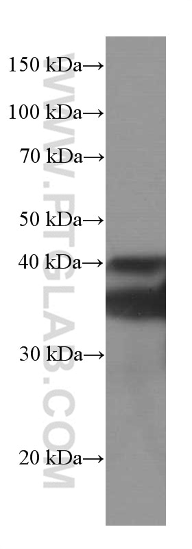 Western Blot (WB) analysis of rat heart tissue using SIRT2 Monoclonal antibody (66410-1-Ig)