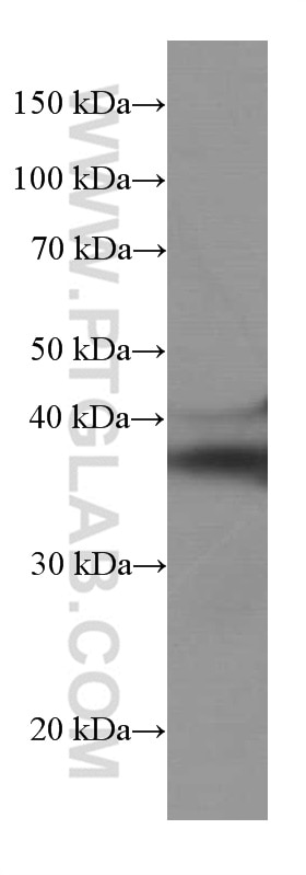 Western Blot (WB) analysis of pig brain tissue using SIRT2 Monoclonal antibody (66410-1-Ig)