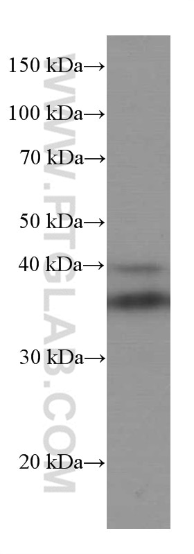 Western Blot (WB) analysis of pig heart tissue using SIRT2 Monoclonal antibody (66410-1-Ig)