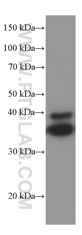 Western Blot (WB) analysis of fetal human brain tissue using SIRT2 Monoclonal antibody (66410-1-Ig)