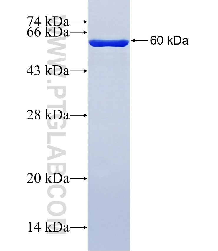 SIRT2 fusion protein Ag7556 SDS-PAGE