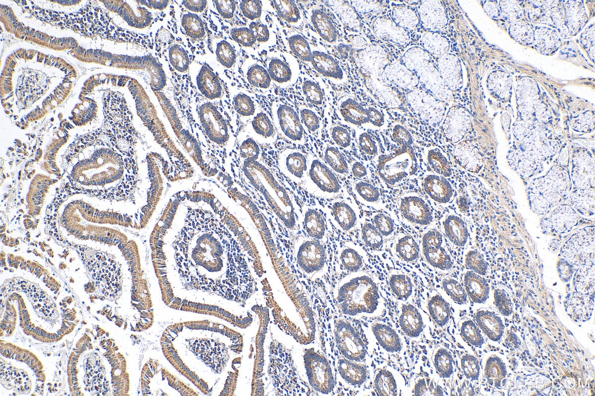 Immunohistochemistry (IHC) staining of human stomach tissue using SIRT3 Polyclonal antibody (10099-1-AP)