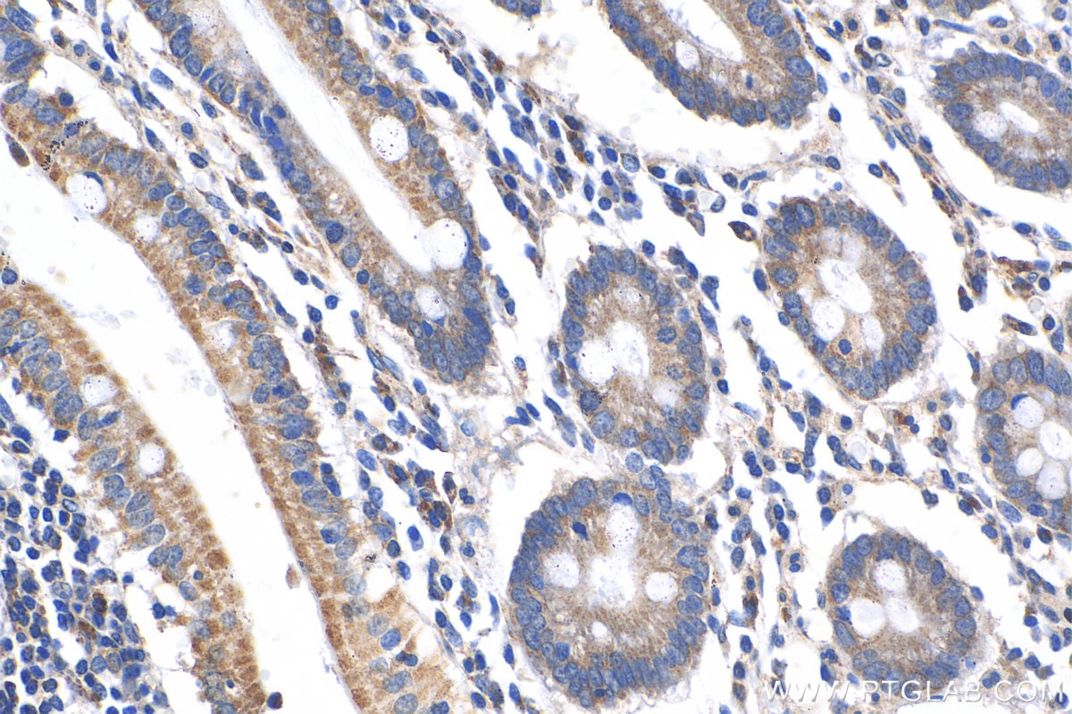 Immunohistochemistry (IHC) staining of human stomach tissue using SIRT3 Polyclonal antibody (10099-1-AP)