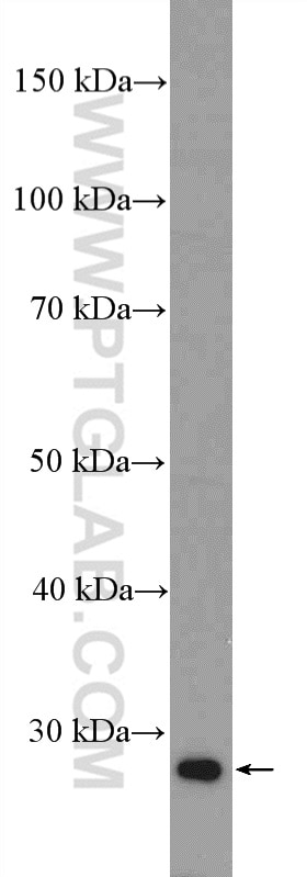 Western Blot (WB) analysis of mouse kidney tissue using SIRT3 Polyclonal antibody (10099-1-AP)