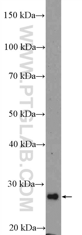 SIRT3 Polyclonal antibody