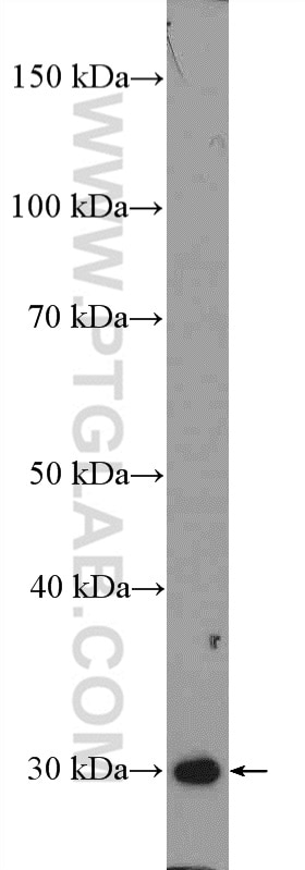 Western Blot (WB) analysis of mouse skeletal muscle tissue using SIRT3 Polyclonal antibody (10099-1-AP)