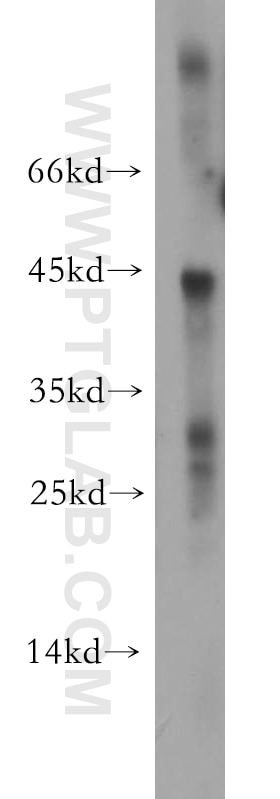 SIRT3 Polyclonal antibody