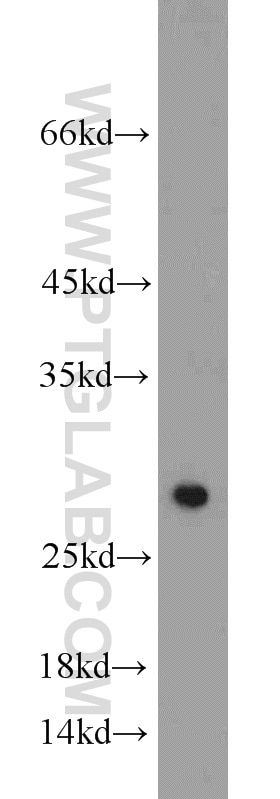 Western Blot (WB) analysis of human spleen tissue using SIRT3 Polyclonal antibody (10099-1-AP)