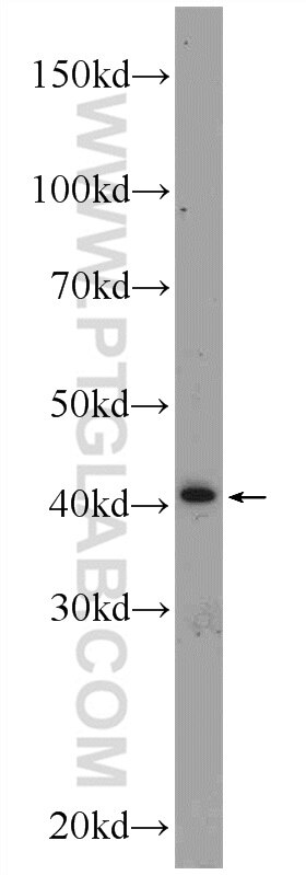 SIRT4 Polyclonal antibody