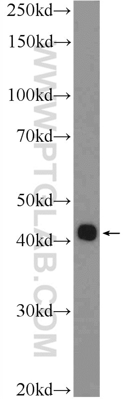 Western Blot (WB) analysis of HeLa cells using SIRT4 Polyclonal antibody (21440-1-AP)