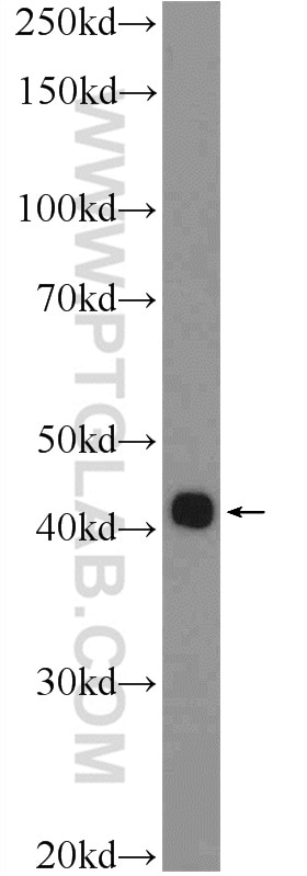 WB analysis of HeLa using 21440-1-AP