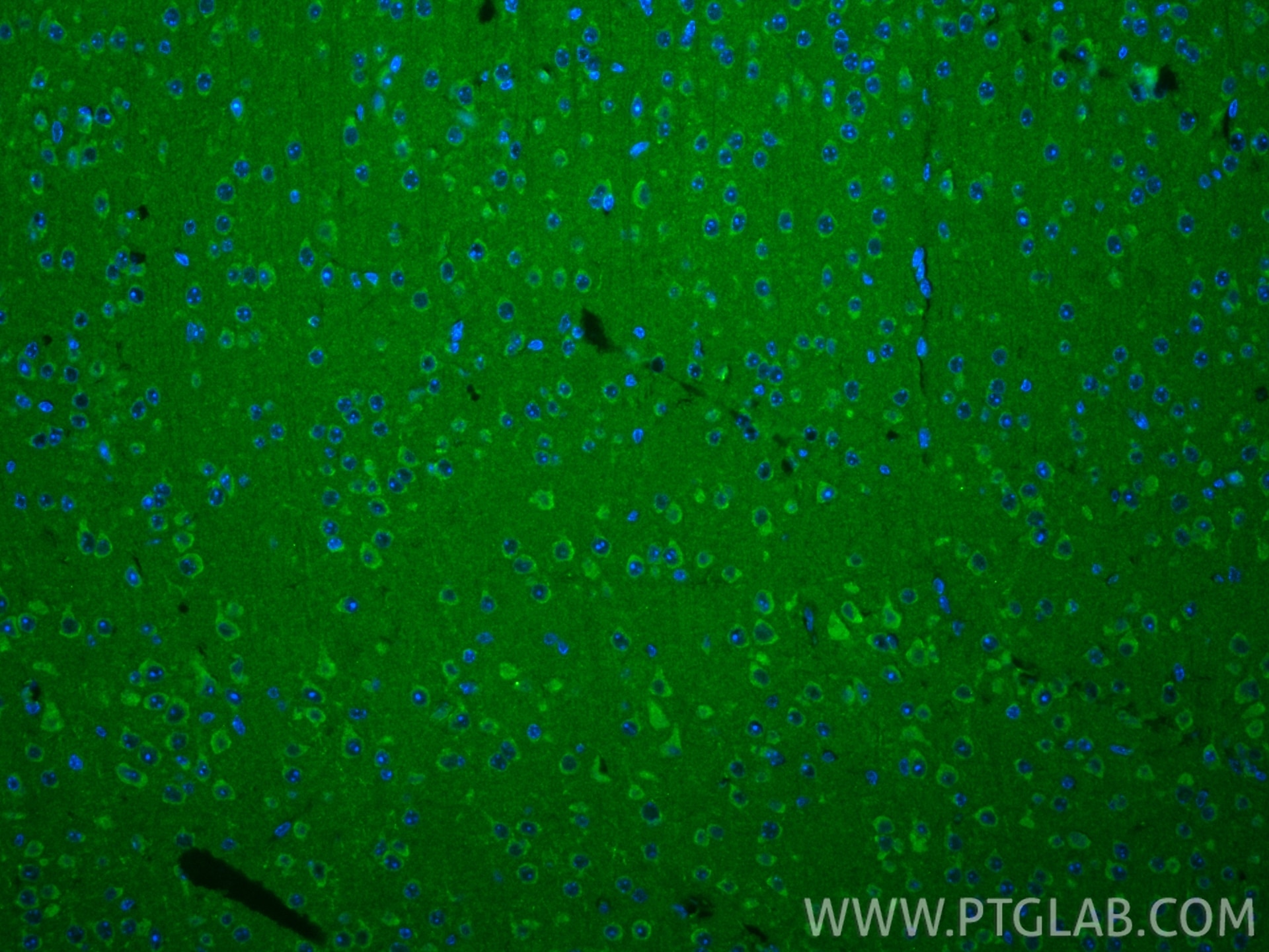 IF Staining of mouse brain using 28148-1-AP Immunofluorescence (IF) / fluorescent staining of mouse brain tissue using SIRT4 Polyclonal antibody (28148-1-AP)