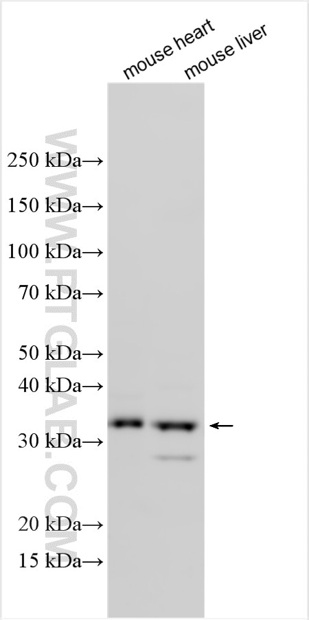 WB analysis using 28148-1-AP Western Blot (WB) analysis of various lysates using SIRT4 Polyclonal antibody (28148-1-AP)