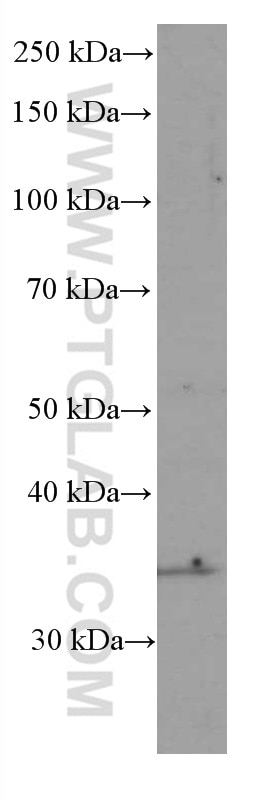 Western Blot (WB) analysis of NCCIT cells using SIRT4 Monoclonal antibody (66543-1-Ig)