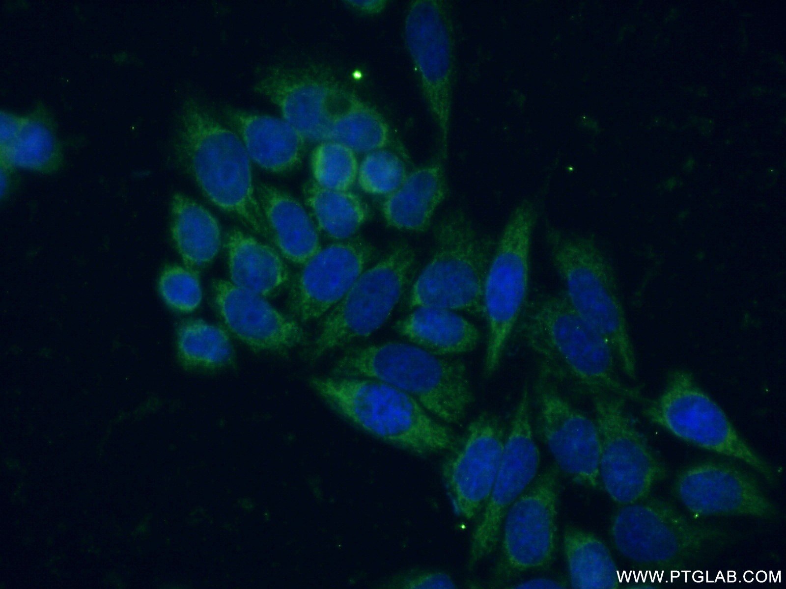 Immunofluorescence (IF) / fluorescent staining of HeLa cells using SIRT5 Polyclonal antibody (15122-1-AP)