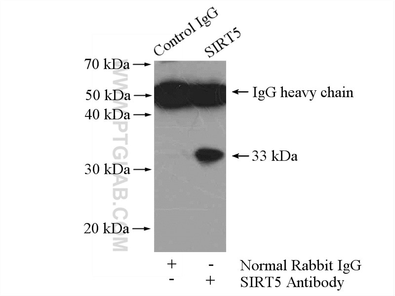Immunoprecipitation (IP) experiment of mouse liver tissue using SIRT5 Polyclonal antibody (15122-1-AP)