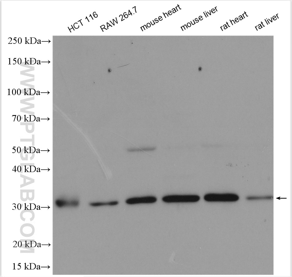 Western Blot (WB) analysis of various lysates using SIRT5 Polyclonal antibody (15122-1-AP)