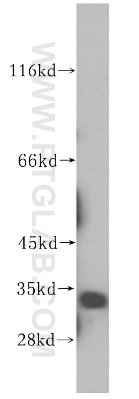 SIRT5 Polyclonal antibody