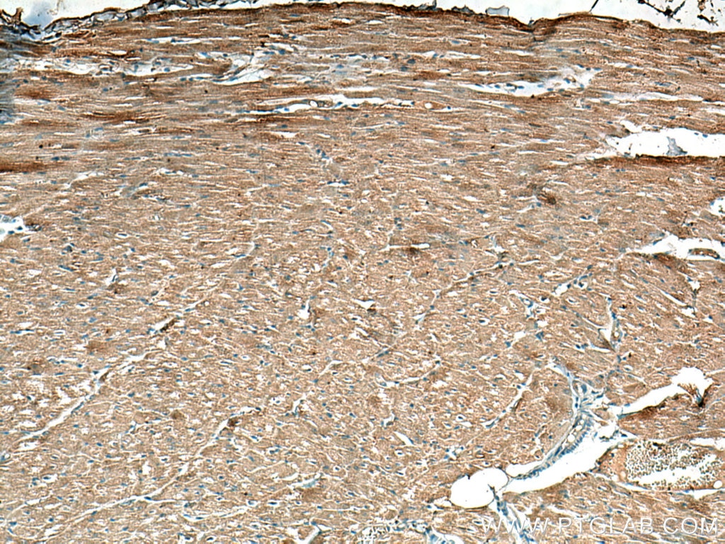 Immunohistochemistry (IHC) staining of human heart tissue using SIRT5 Monoclonal antibody (67257-1-Ig)