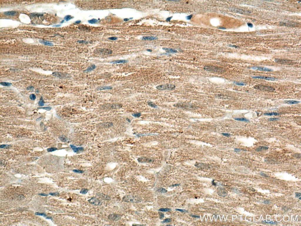 Immunohistochemistry (IHC) staining of human heart tissue using SIRT5 Monoclonal antibody (67257-1-Ig)